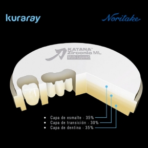 KATANA ZR ML A LIGHT COLLAR T:18MM