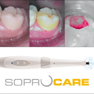 CAMARA SOPROCARE SATELEC